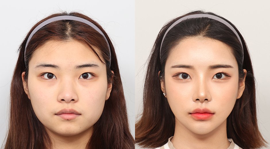 ทำสวยที่เกาหลี